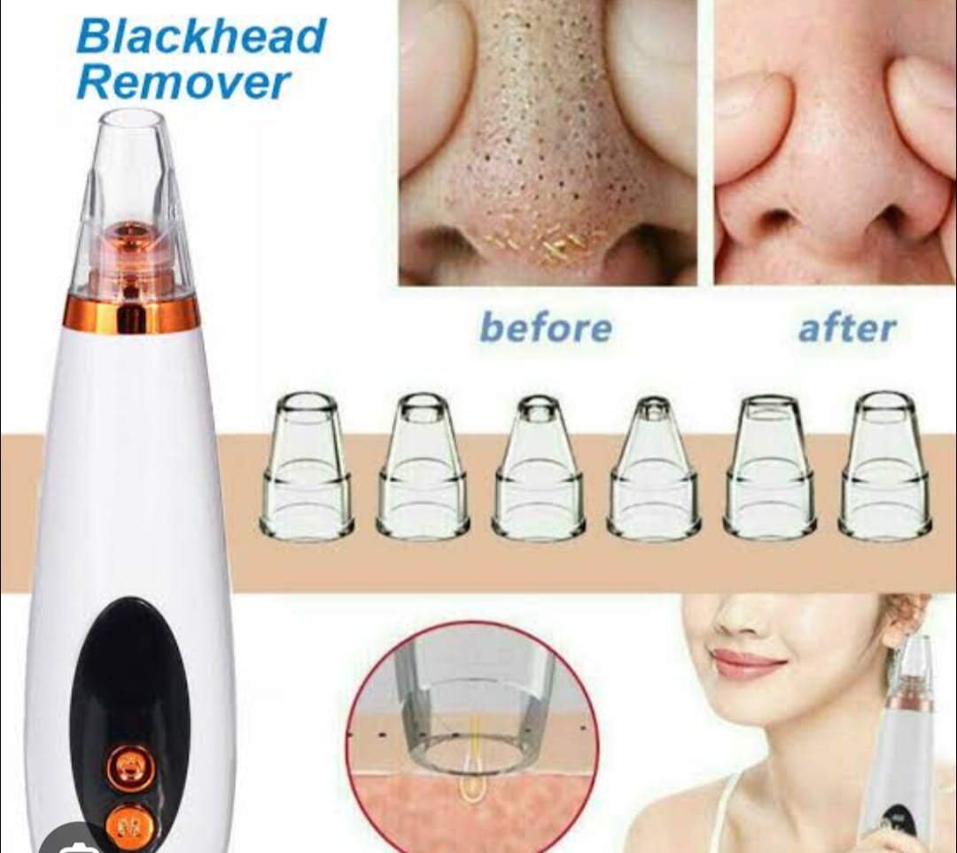 Blackhead Remover Machine Price in Bangladesh | ব্ল্যাকহেড রিমুভার মেশিন দাম