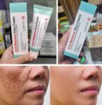 Anti Melasma Cica Cream 40ml – মেলাসমা দূর করার জন্য কার্যকর সিকা ক্রিম