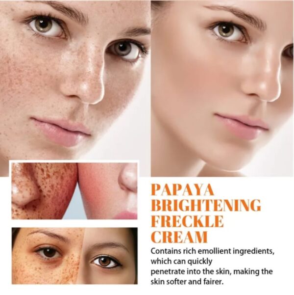 Papaya Day Night Cream for Freckles & Dark Spots | পেঁপে ডে নাইট ক্রিম দাম বাংলাদেশ
